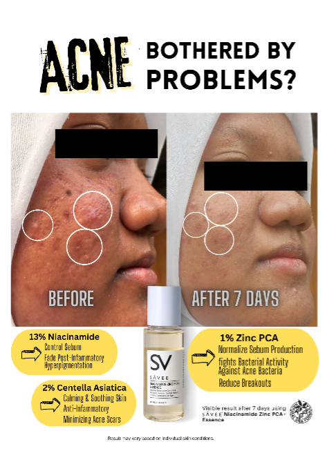 SÁVEE NIACINAMIDE ZINC PCA+ ESSENCE